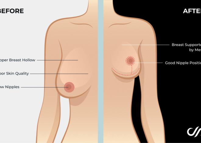 Breast Weight Loss: Effective Strategies Revealed