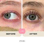 Orbital Fat Loss: Transform Your Eye Area Now