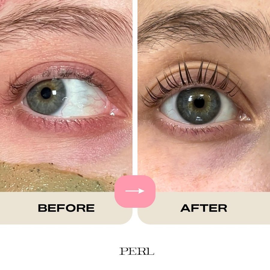 Orbital Fat Loss: Transform Your Eye Area Now